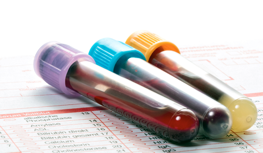 Blood Test To Detect Eight  Cancers Is Promising