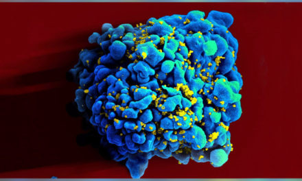 Scientists Try Gene-editing Tool CRISPR To Fight HIV
